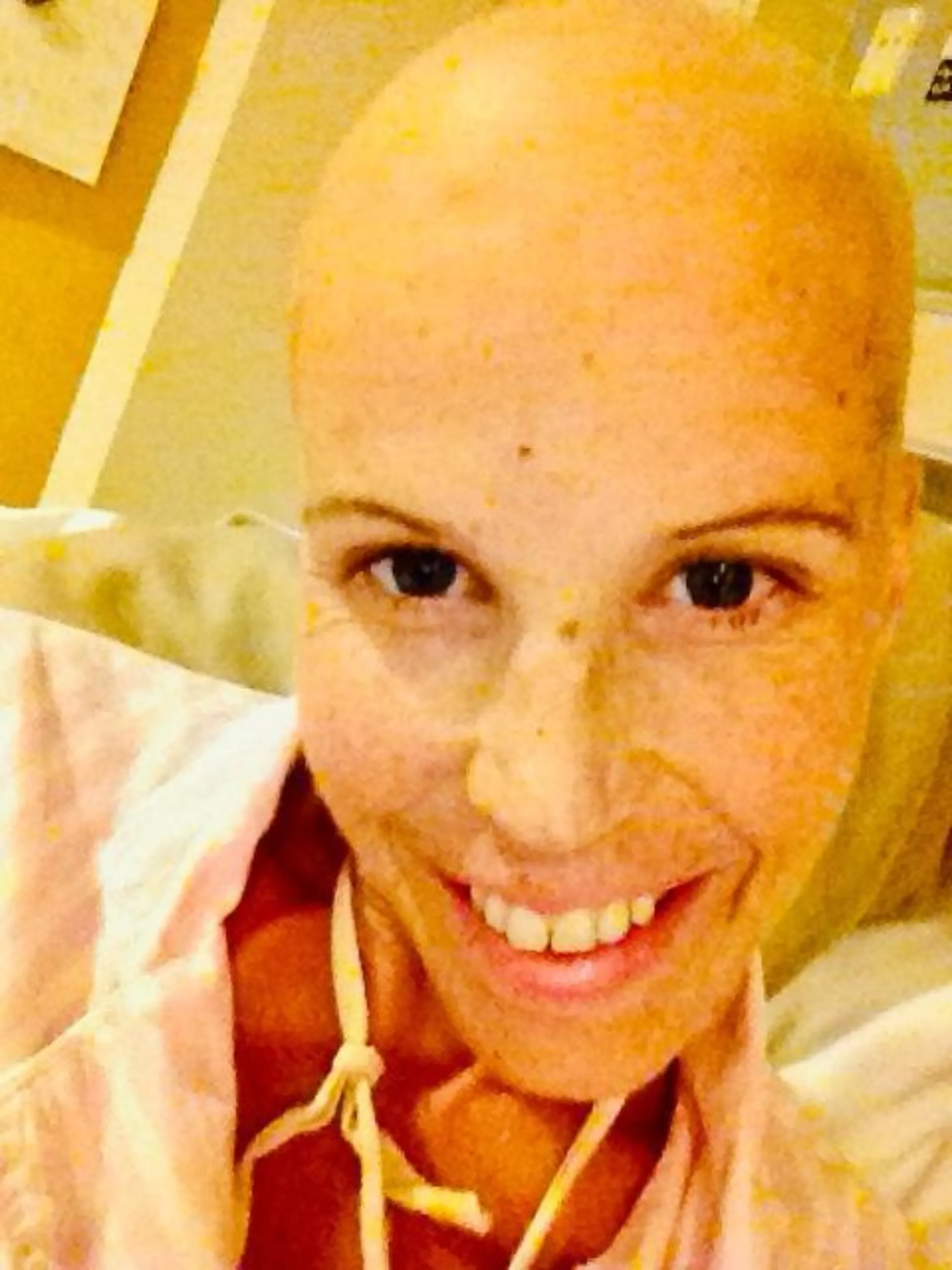 Erica cancer bald striped pyjamas